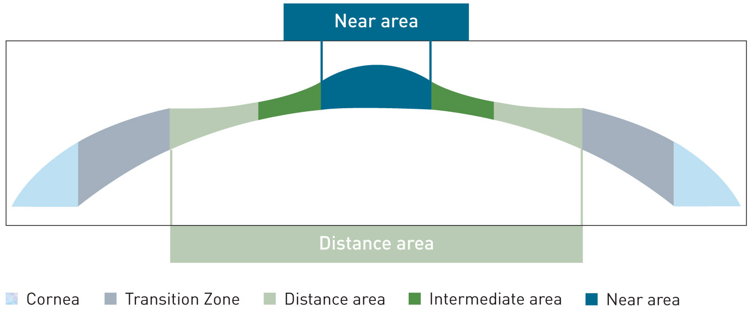 Graphic segmentation of individual sight areas