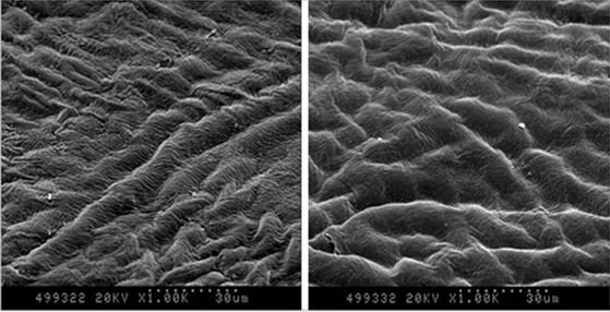 Scanning Electron Microscope (SEM) images at 1000x showing part of the central corneal stroma after TransPRK with AMARIS technology, without SmartPulse (left) and with SmartPulse (right). 