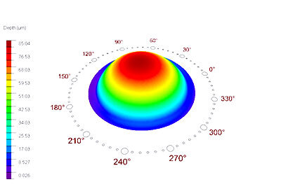 Height scale of an eye during treatment with ORK Cam