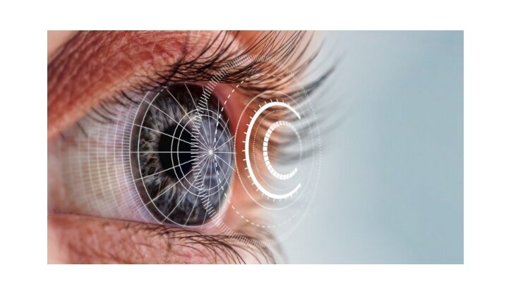 SCHWIND Foresight®  software for post-operative corneal visualisation