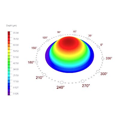 Height scale of an eye during treatment with ORK Cam