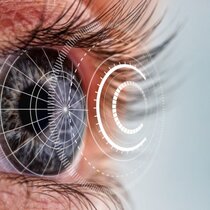 SCHWIND Foresight® Visual | © SCHWIND eye-tech-solutions GmbH