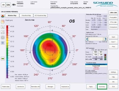 Bildschirmaufnahme während der Behandlung mit okularer Wellenfront