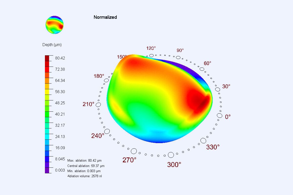 Screenshot during treatment with injured cornea