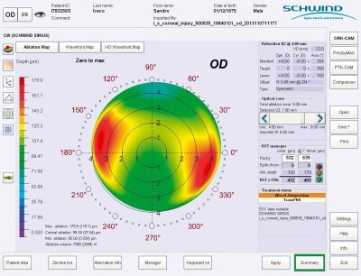 Screenshot during treatment with corneal wavefront