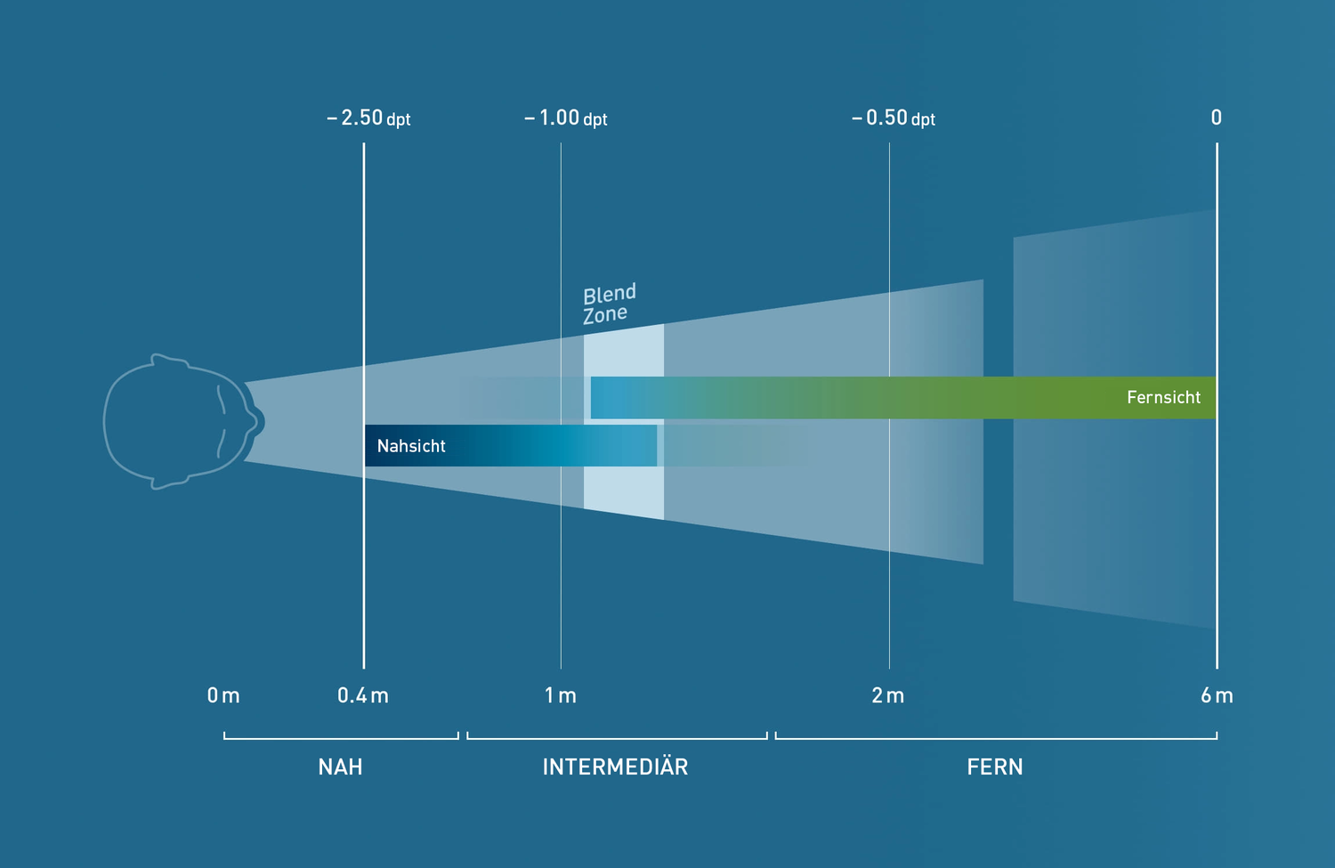 Visualisierung PresbyMAX® Hybrid