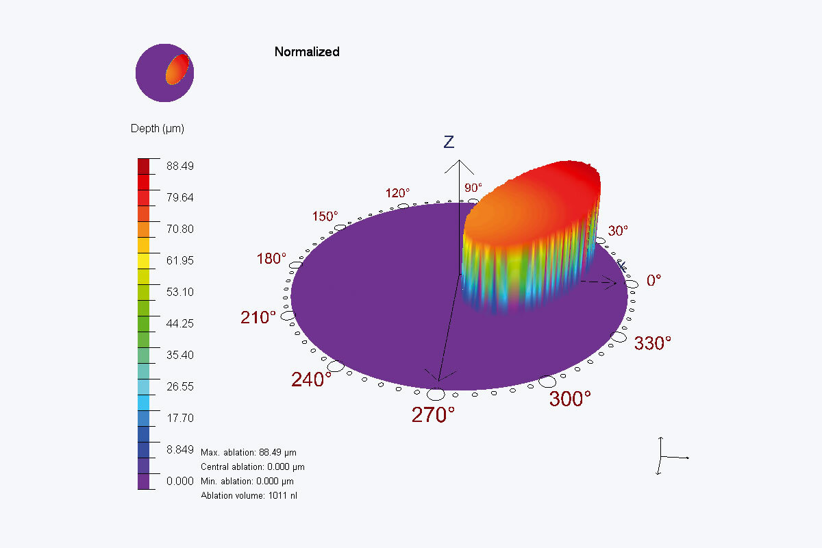 Oval height scale of an eye during treatment with PTK Cam