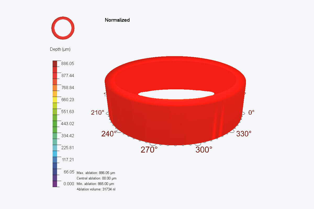 Ring height scale of an eye during treatment with PTK Cam