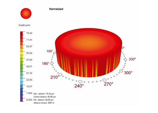 Ablation profile CAM with PTK