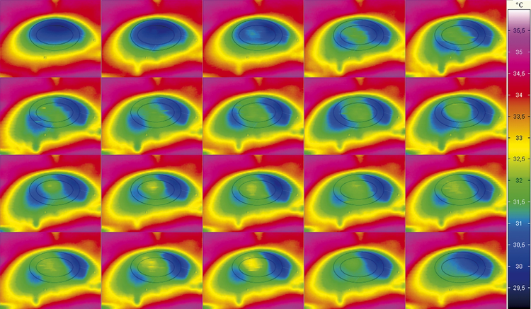 Thermal Sequence in vivo