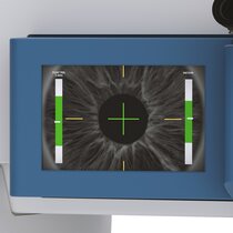 CenTrax® | © SCHWIND eye-tech-solutions GmbH