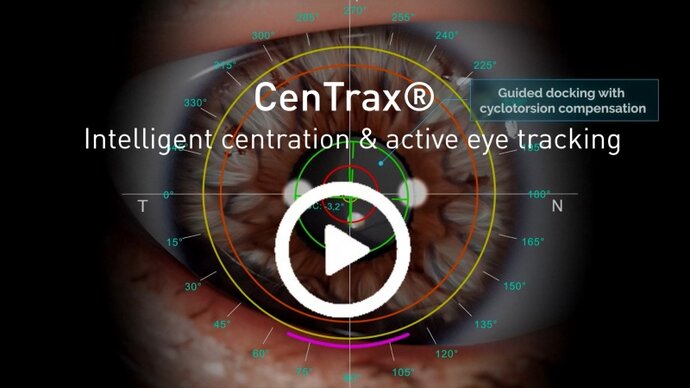 thumbnail product video: SCHWIND ATOS® with Centrax®