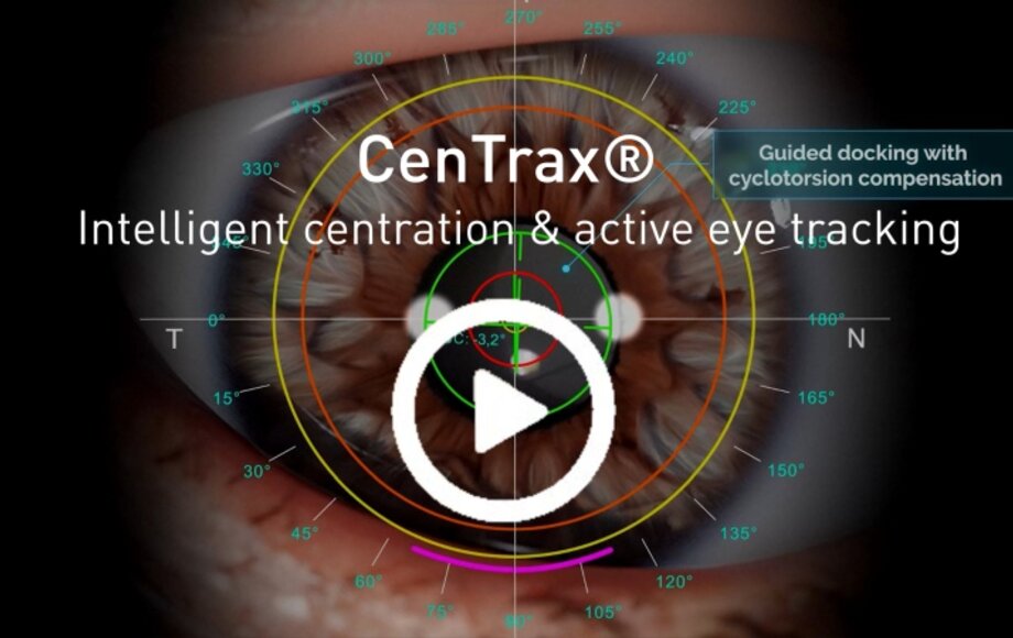 thumbnail product video: SCHWIND ATOS® with Centrax® | © SCHWIND eye-tech-solutions GmbH