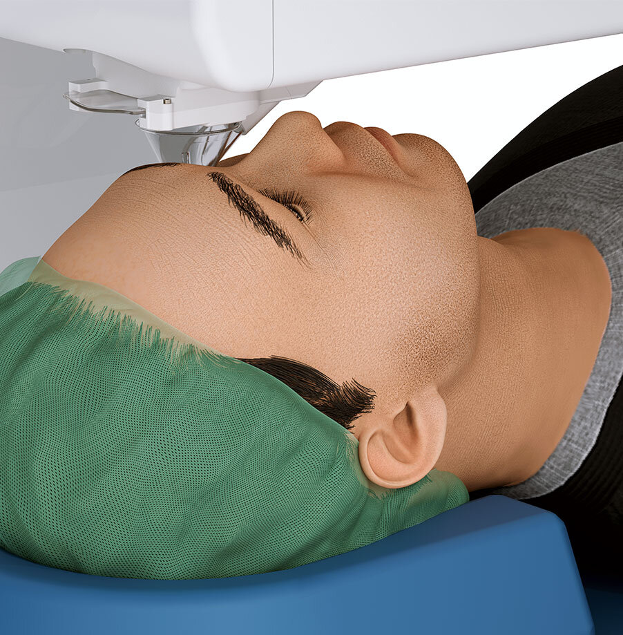 SCHWIND ATOS patient interface