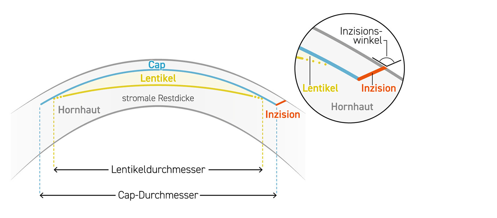 SCHWIND SmartSight Lenktikel Grafik