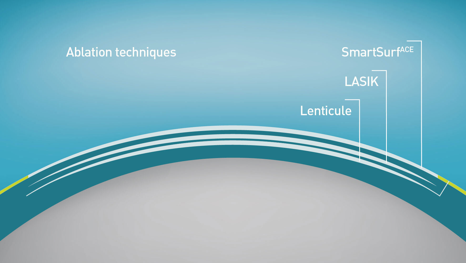 Grafic of an eye with the comparison in depth of various treatment methods.