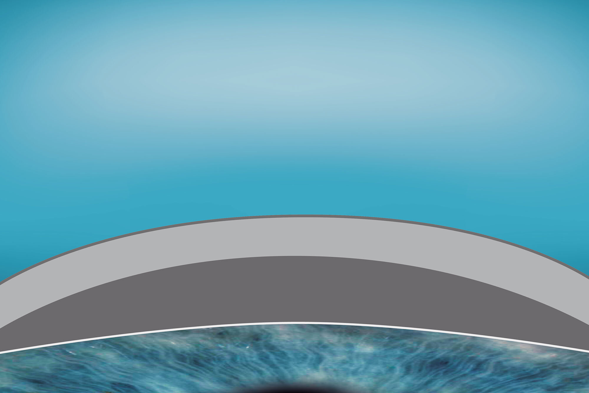 Illustration of regular cornea 1