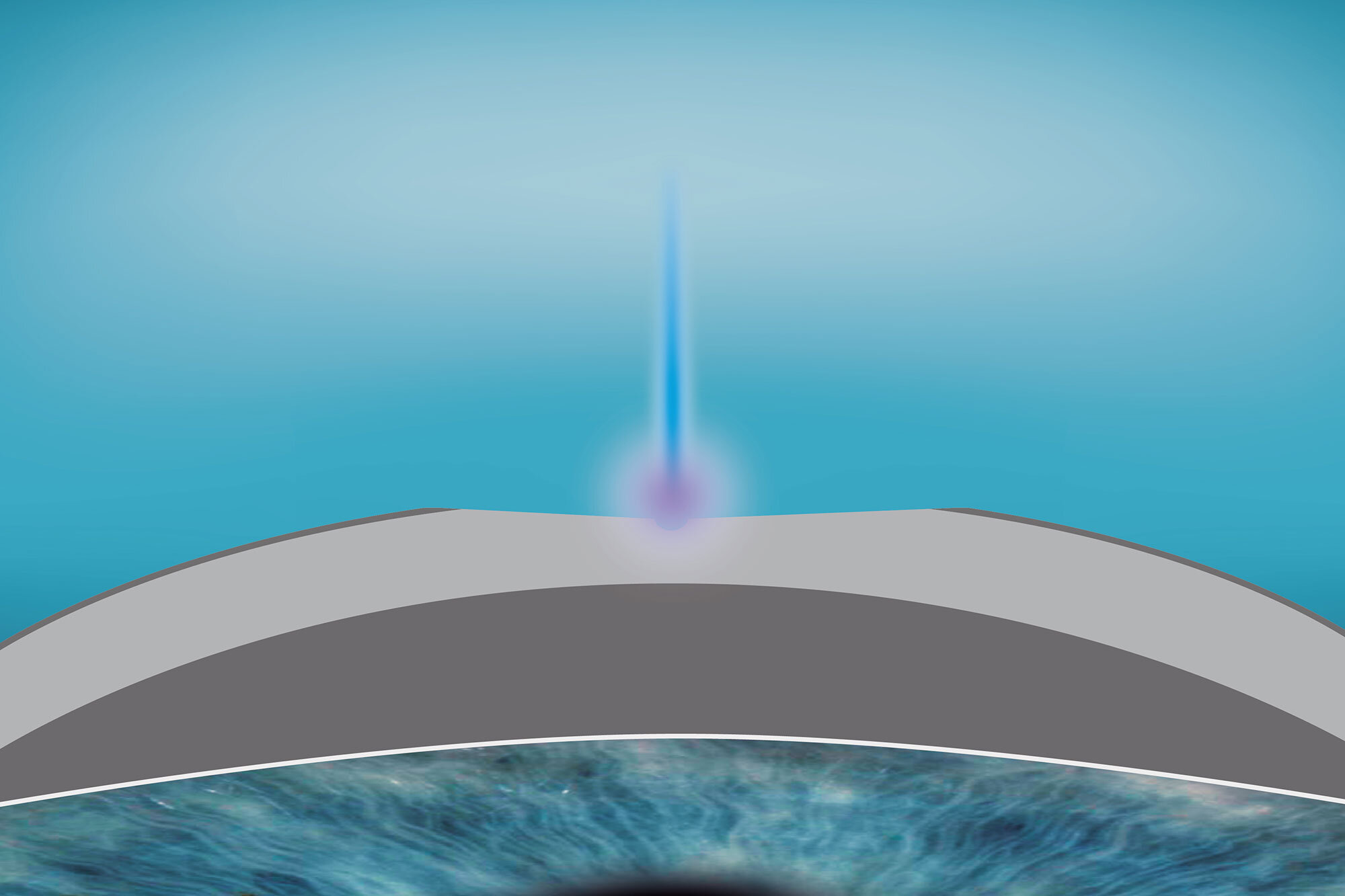 Illustration of regular cornea 2