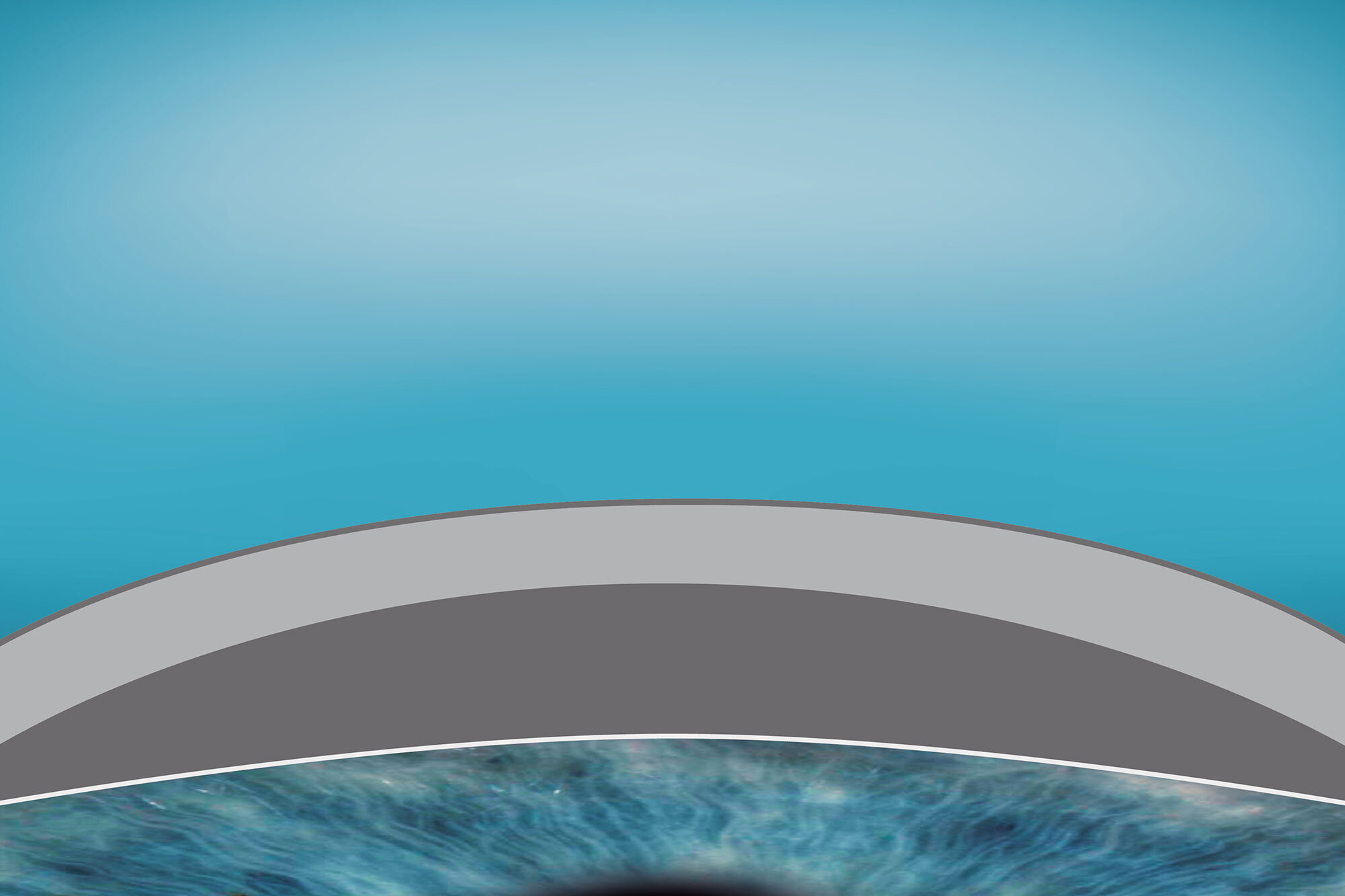 Illustration of regular cornea 4